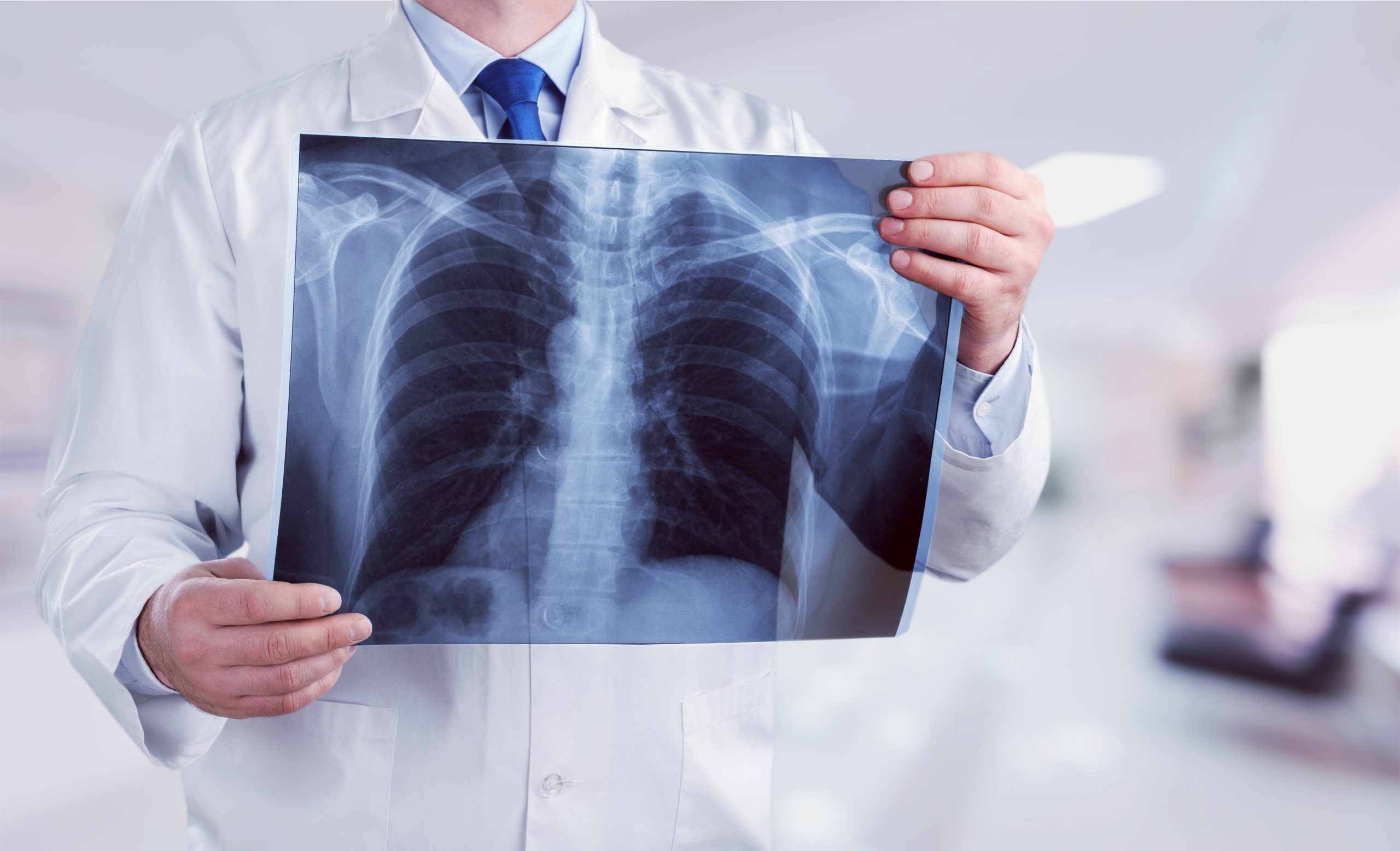 Zapalenie płuc - lekarz online - Telemedi.com