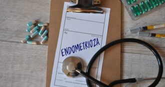 Endometrioza - lekarz online - Telemedi.com